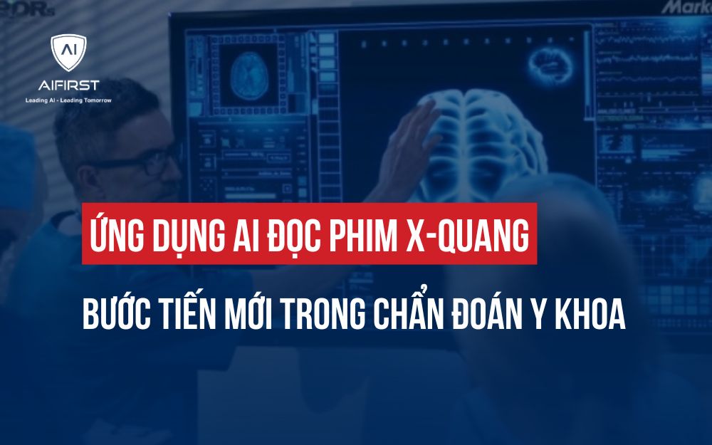 ỨNG DỤNG AI ĐỌC PHIM X-QUANG: BƯỚC TIẾN MỚI TRONG CHẨN ĐOÁN Y KHOA