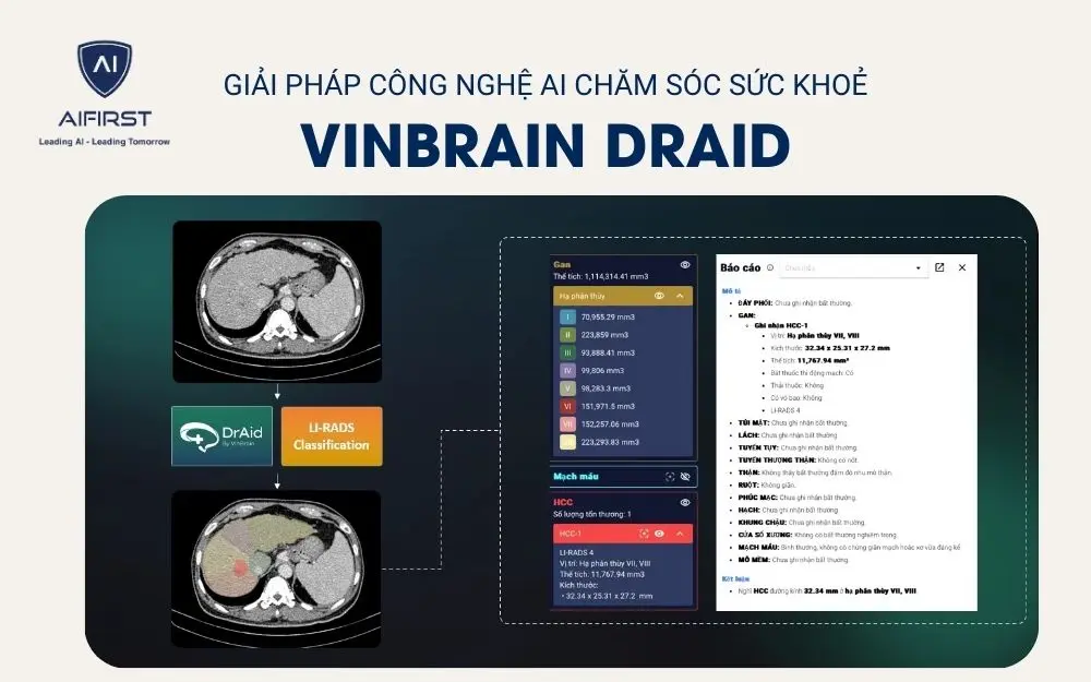 VinBrain DrAid