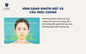 Hình dáng khuôn mặt và cấu trúc xương