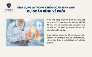 Ứng dụng AI chẩn đoán hình ảnh dự đoán bệnh về phổi